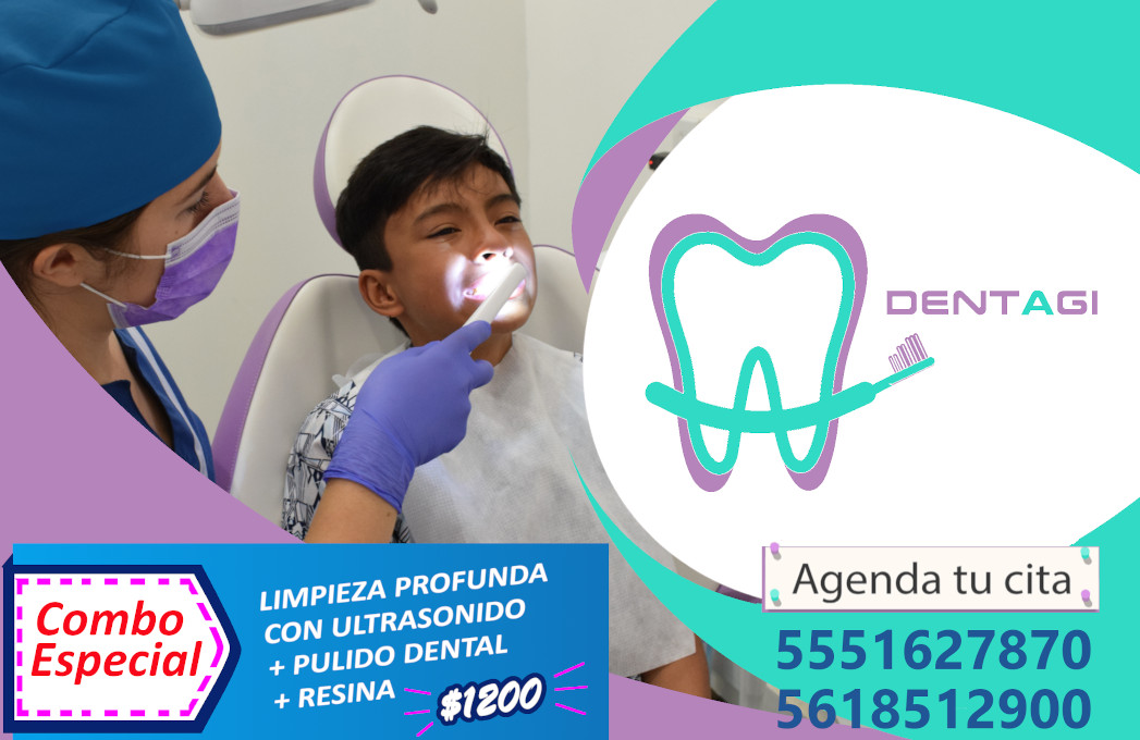 Limpieza dental con ultrasonido + Pulido dental + Valoración + Resina.
