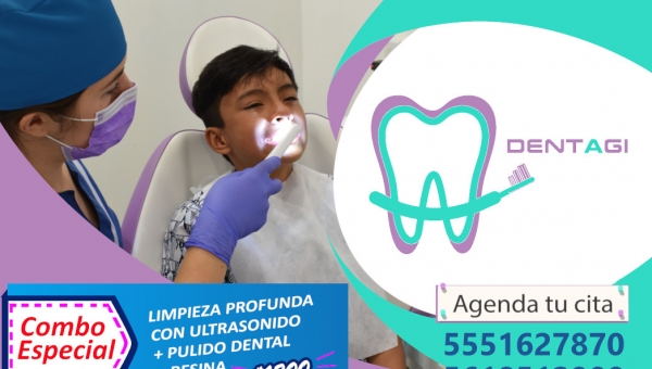 Limpieza dental con ultrasonido + Pulido dental + Valoración + Resina.