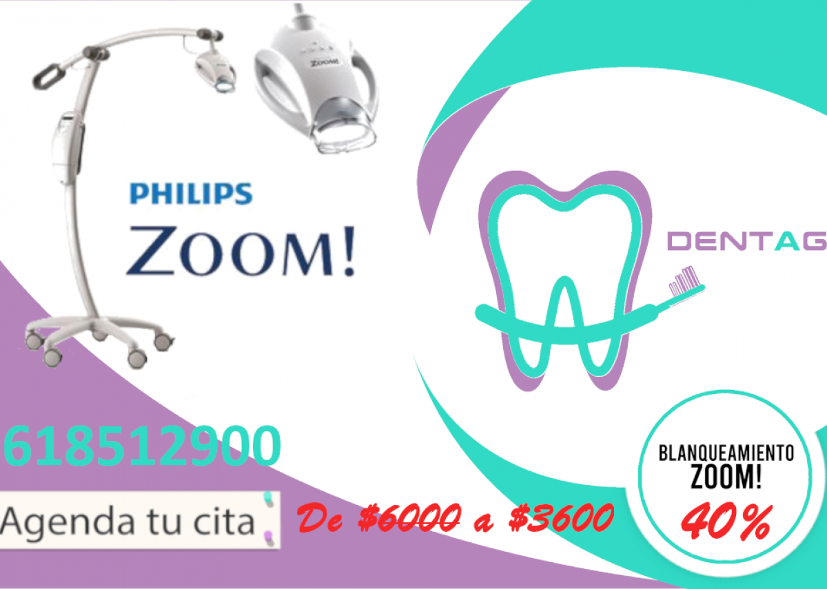 Blanqueamiento dental Zoom
